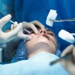 Consejos antes de realizar cirugia plástica