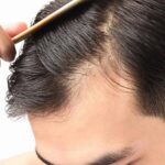 Caida del cabello